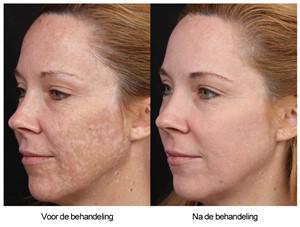 Klik voor grote afbeelding
